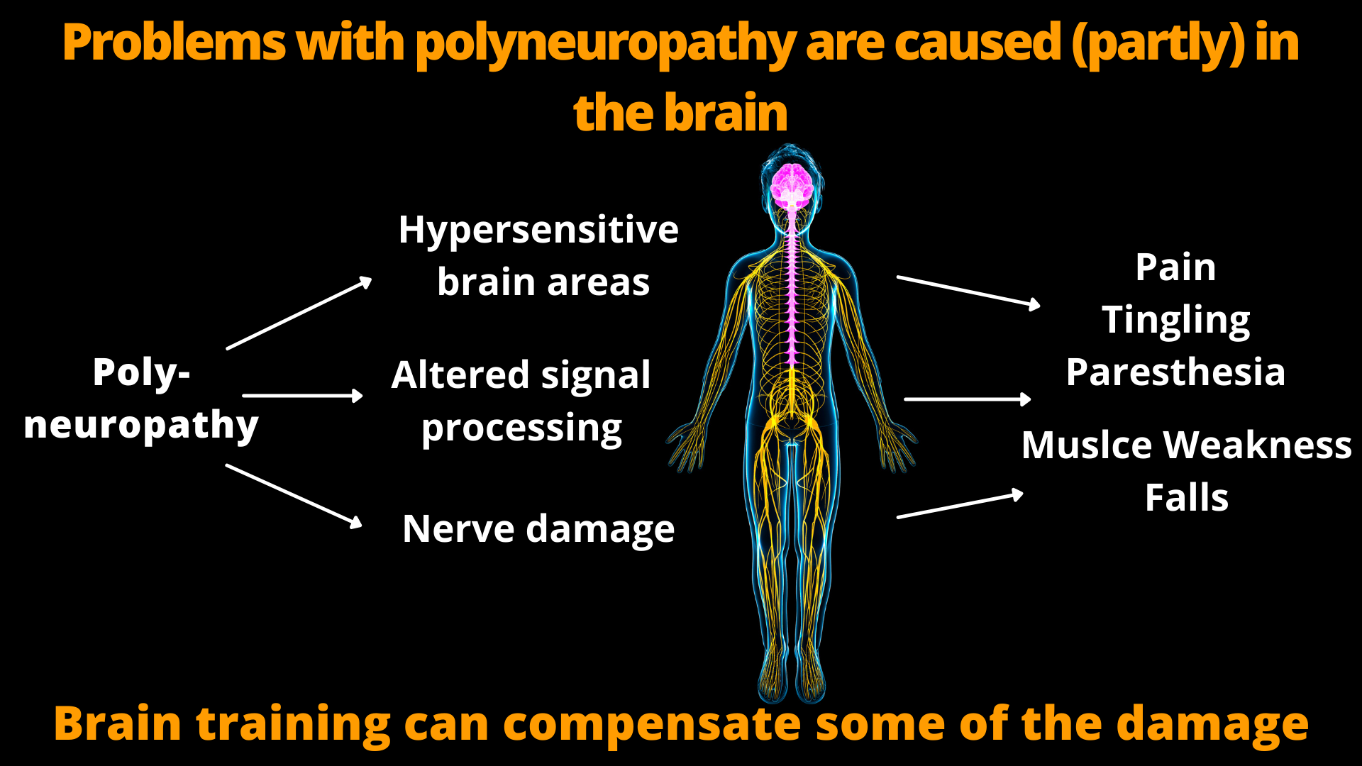 Balance training in physiotherapy for polyneuropathy